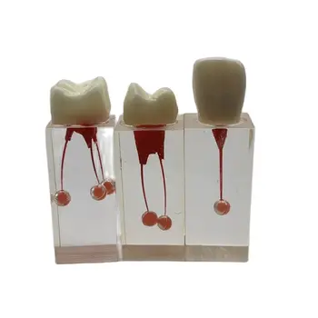 Учебни пособия за стоматология Образователна модел Endo Training Block Модели на коренови канали